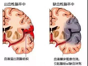 石家庄出院救护